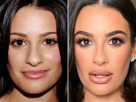 lea michele before and after plastic surgery